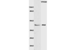 Rat liver lysate probed with Anti VASH1 Polyclonal Antibody, Unconjugated  at 1:3000 for 90 min at 37˚C. (VASH1 antibody  (AA 281-365))