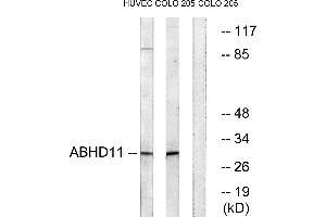 Western blot analysis of extracts from HUVEC cells and COLO cells, using ABHD11 antibody. (ABHD11 antibody)