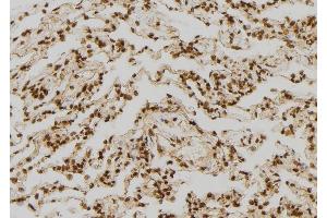 ABIN6277324 at 1/100 staining Human lung tissue by IHC-P. (FABP7 antibody  (C-Term))