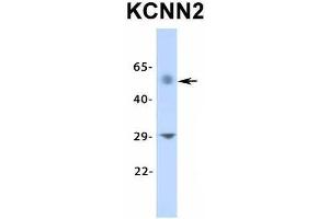Host:  Rabbit  Target Name:  KCNN2  Sample Type:  Human Fetal Muscle  Antibody Dilution:  1. (KCNN2 antibody  (Middle Region))
