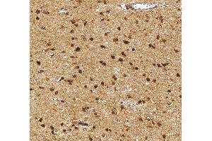 IHC analysis of HES5 using anti-HES5 antibody (ABIN7598966). (HES5 antibody  (AA 1-121))