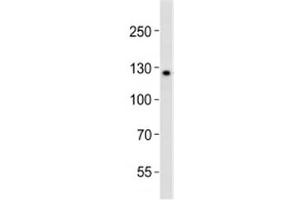 Western blot analysis of lysate from K562 cell line using LIFR antibody diluted at 1:1000.