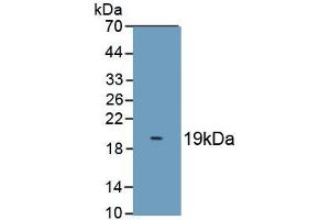 Detection of Recombinant S100A8, Cattle using Polyclonal Antibody to S100 Calcium Binding Protein A8 (S100A8) (S100A8 antibody  (AA 1-89))