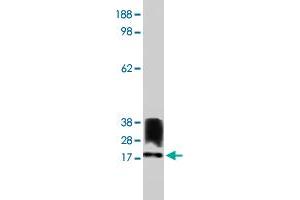 Western blot using ALOX5AP polyclonal antibody on human kidney cell lysate. (ALOX5AP antibody)