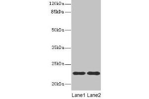 Western blot All lanes: ASF1B antibody at 13 μg/mL Lane 1: MCF-7 whole cell lysate Lane 2: Jurkat whole cell lysate Secondary Goat polyclonal to rabbit IgG at 1/10000 dilution Predicted band size: 23 kDa Observed band size: 23 kDa (ASF1B antibody  (AA 1-202))