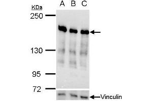 WB Image Ribosome binding protein 1 antibody validation by siRNA knock-down. (RRBP1 antibody  (C-Term))