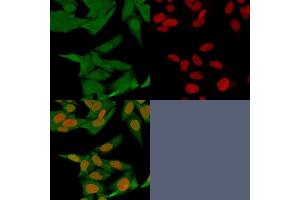 Immunofluorescence staining of HeLa cells using S100A4 Mouse Monoclonal Antibody (S100A4/1481) followed by goat anti-Mouse IgG conjugated to CF488 (green).