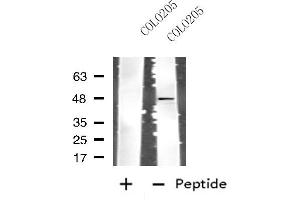 Western blot analysis of extracts from COLO205 cells, using CSF2RA antibody.