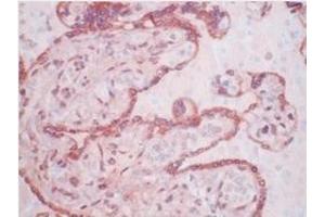 Immunohistochemistry (IHC) image for anti-Matrix Metallopeptidase 11 (Stromelysin 3) (MMP11) antibody (ABIN781659) (MMP11 antibody)