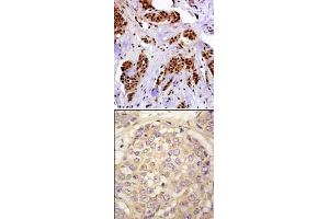 Image no. 2 for anti-Melanoma Antigen Family A, 4 (MAGEA4) (N-Term) antibody (ABIN358647)