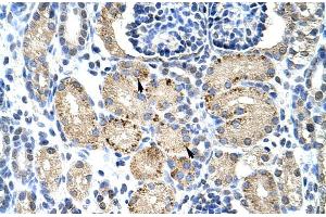 Rabbit Anti-ELL Antibody Catalog Number: ARP30105 Paraffin Embedded Tissue: Human Kidney Cellular Data: Epithelial cells of renal tubule Antibody Concentration: 4. (ELL antibody  (C-Term))