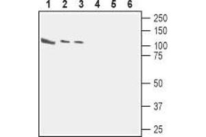 Western blot analysis of rat brain (lanes 1 and 4), mouse brain (lanes 2 and 5) and human neuroblastoma (SH-SY5Y) (lanes 3 and 6) cell line lysates: - 1,2. (CASK antibody  (Intracellular))