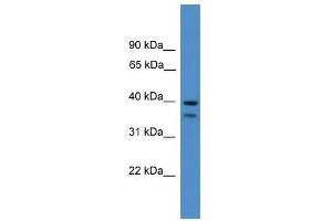 SERPINB6 antibody used at 0.