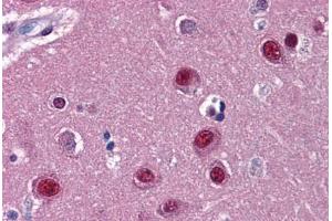 Immunohistochemistry (Formalin-fixed Paraffin-embedded Sections) (IHC (fp)) image for anti-Nuclear Receptor Subfamily 1, Group D, Member 1 (NR1D1) (AA 1-615) antibody (ABIN574412)