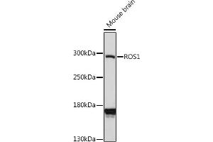 Western blot analysis of extracts of mouse brain, using ROS1 antibody (ABIN7265974) at 1:1000 dilution. (ROS1 antibody  (AA 2100-2200))