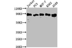 Western Blot Positive WB detected in: Jurkat whole cell lysate, PC3 whole cell lysate, MCF-7 whole cell lysate, K562 whole cell lysate, A549 whole cell lysate All lanes: BRAT1 antibody at 1:2000 Secondary Goat polyclonal to rabbit IgG at 1/50000 dilution Predicted band size: 89, 31, 32 kDa Observed band size: 89 kDa (BAAT1 antibody  (AA 603-821))