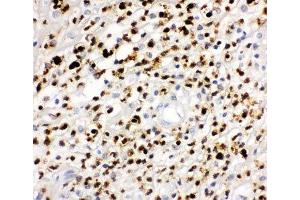 IHC-P: MPO antibody testing of human appendicitis tissue (Myeloperoxidase antibody  (AA 406-745))