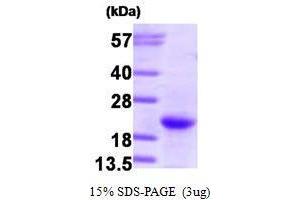 Figure annotation denotes ug of protein loaded and % gel used. (GTPase NRas Protein (NRAS) (AA 1-186))