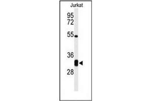 Western blot analysis of CPSF4 Antibody (Center) in Jurkat cell line lysates (35ug/lane). (CPSF4 antibody  (Middle Region))