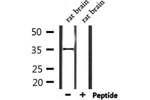 Western blot analysis of extracts from rat brain, using OR2L2 Antibody. (OR2L2 antibody)