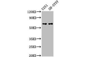 Western Blot Positive WB detected in: U251 whole cell lysate, SH-SY5Y whole cell lysate All lanes: Nox4 antibody at 3. (NADPH Oxidase 4 antibody  (AA 210-424))