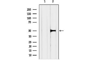 anti-Matrix Metallopeptidase 24 (Membrane-inserted) (MMP24) (Internal Region) antibody