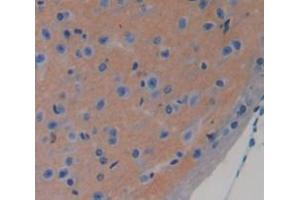 Used in DAB staining on fromalin fixed paraffin- embedded brain tissue (CHRDL1 antibody  (AA 272-447))