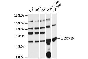 Western blot analysis of extracts of various cell lines, using WBSCR16 antibody (ABIN7271367) at 1:3000 dilution. (WBSCR16 antibody  (AA 1-230))