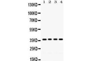 Western Blotting (WB) image for anti-Forkhead Box A3 (FOXA3) (AA 291-324), (C-Term) antibody (ABIN3042401) (FOXA3 antibody  (C-Term))