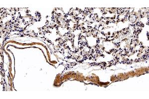 Detection of VEGFA in Rat Lung Tissue using Polyclonal Antibody to Vascular Endothelial Growth Factor A (VEGFA)