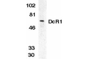 Image no. 1 for anti-Tumor Necrosis Factor Receptor Superfamily, Member 10c (TNFRSF10C) (Extracellular Domain) antibody (ABIN203554) (DcR1 antibody  (Extracellular Domain))
