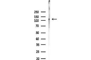 anti-Guanylate Cyclase 2C (Heat Stable Enterotoxin Receptor) (GUCY2C) antibody