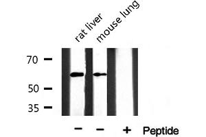 Western blot analysis of extracts of various tissue ,using Keratin 10 antibody. (Keratin 10 antibody  (Internal Region))