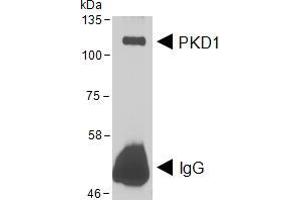 HEK293 lysate overexpressing Human DYKDDDDK-tagged PKD1 was used to immunoprecipitate PKD1 with 2ug Antibody. (PKC mu antibody  (AA 233-246))
