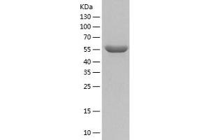 Western Blotting (WB) image for Pyruvate Kinase M2 (PKM2) (AA 1-531) protein (His tag) (ABIN7124724) (PKM2 Protein (AA 1-531) (His tag))