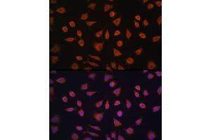 Immunofluorescence analysis of L929 cells using PFKFB2 Rabbit pAb (ABIN6129842, ABIN6145483, ABIN6145484 and ABIN6224971) at dilution of 1:100 (40x lens). (PFKFB2 antibody  (AA 446-505))