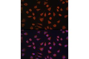 Immunofluorescence analysis of L929 cells using PFKFB2 Rabbit pAb (ABIN6129842, ABIN6145483, ABIN6145484 and ABIN6224971) at dilution of 1:100 (40x lens). (PFKFB2 antibody  (AA 446-505))