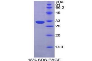 SDS-PAGE analysis of Mouse EPHA1 Protein.