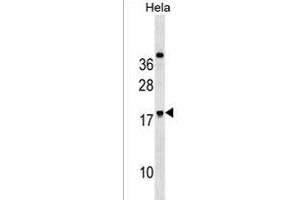 RN Antibody (Center) (ABIN1538629 and ABIN2850418) western blot analysis in Hela cell line lysates (35 μg/lane). (RNF224 antibody  (AA 79-105))