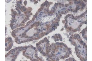 DAB staining on IHC-P; Samples: Human Thyroid Tissue (UXT antibody  (AA 15-157))