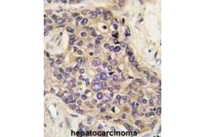 Immunohistochemistry (IHC) image for anti-Hepatocyte Growth Factor (Hepapoietin A, Scatter Factor) (HGF) antibody (ABIN2999319) (HGF antibody)
