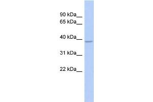 WB Suggested Anti-SOX7 Antibody Titration:  1 ug/ml  Positive Control:  Fetal Stomach cell lysate (SOX7 antibody  (Middle Region))