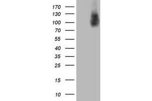 HEK293T cells were transfected with the pCMV6-ENTRY control (Left lane) or pCMV6-ENTRY HLCS (Right lane) cDNA for 48 hrs and lysed. (HLCS antibody)