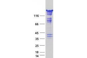 Validation with Western Blot