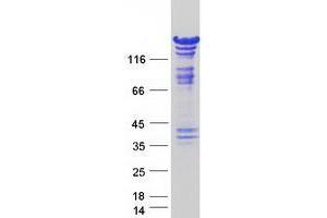 Validation with Western Blot (SMARCC2 Protein (Transcript Variant 2) (Myc-DYKDDDDK Tag))