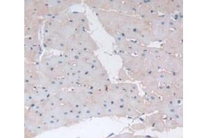 Figure. (Cathepsin B antibody  (AA 129-333))