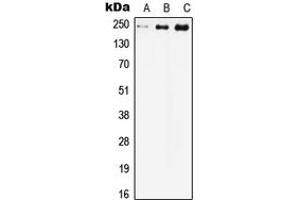 Western blot analysis of Cav1.