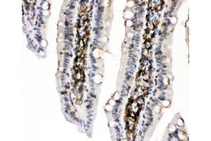 IHC analysis of PKC alpha using anti-PKC alpha antibody (ABIN3043549). (PKC alpha antibody  (AA 153-342))