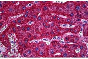 Human Liver: Formalin-Fixed, Paraffin-Embedded (FFPE) (SLC13A5 antibody  (AA 152-207))