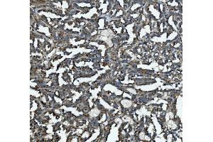 IHC analysis of GLB1/Beta-galactosidase using anti-GLB1/Beta-galactosidase antibody (ABIN7601806).
